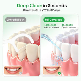 Water Dental Flosser for Teeth, 300ML Cordless Flosser with Constant Pressure, Rechargeable Oral Irrigator Cleaner for Travel Home Use and Braces