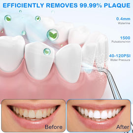 Water Dental Flosser for Teeth Cleaning and Flossing with Travel Size Case – Rechargeable Oral Irrigator, Portable Water Flosser for Adults